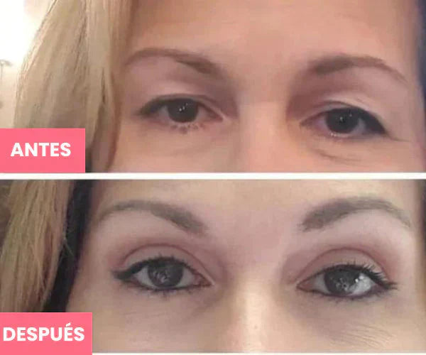 2X1😍🎁Disminuye el 80% del efecto párpado caído al instante - Realza Tus Párpados Caídos