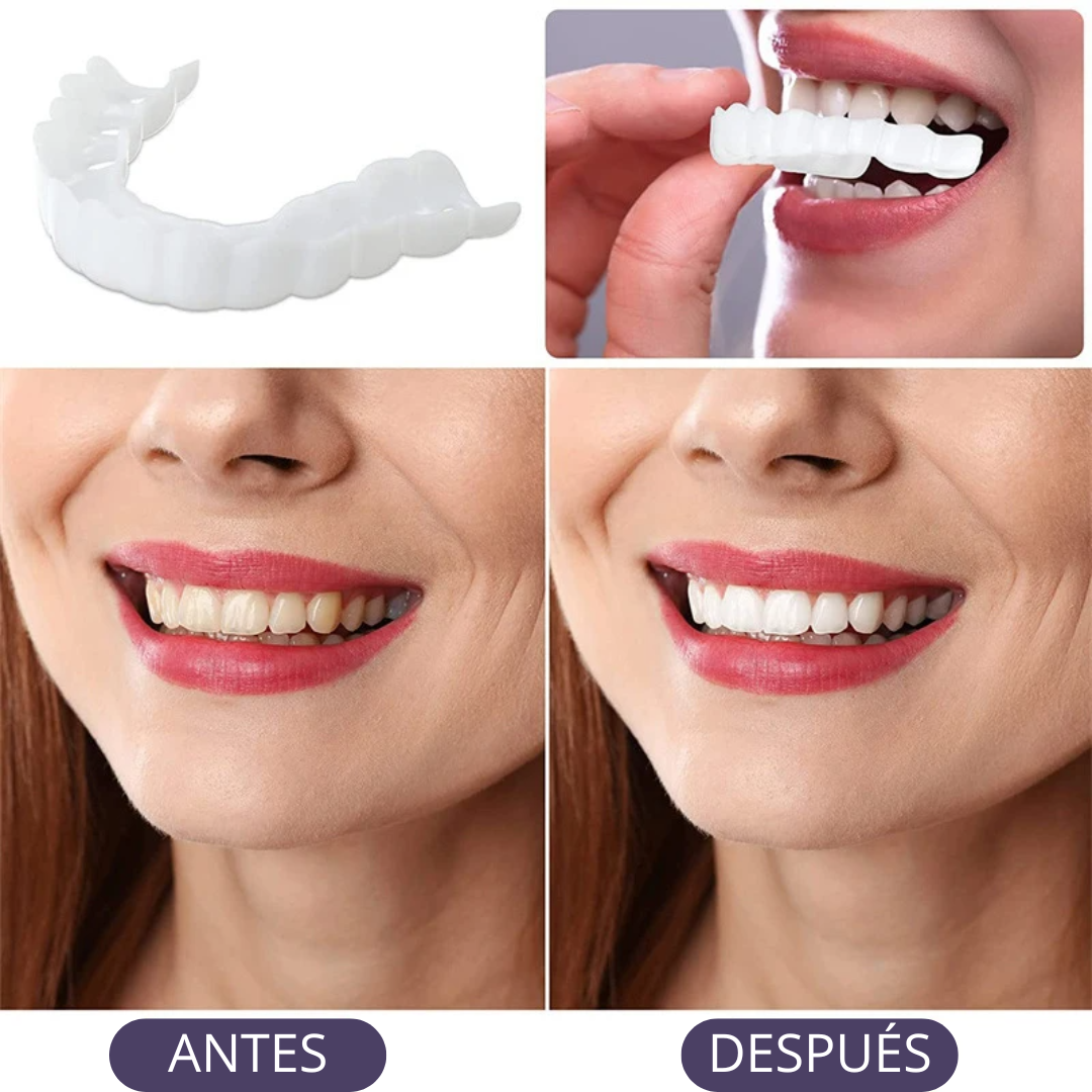 Carillas Dentales Adaptables - Transforma tu Sonrisa 😱OFERTA EXCLUSIVA 3X1😱